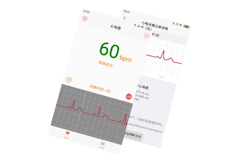 APP集成實(shí)例---心電芯片、心電手環(huán)芯片、可穿戴心電設(shè)備、智能監(jiān)護(hù)儀